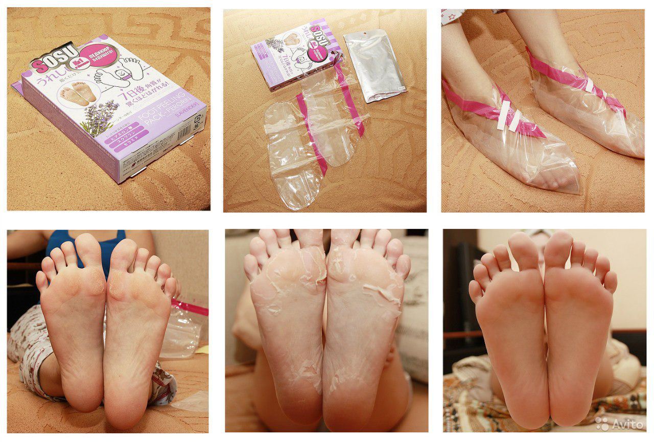 Корейские носки для педикюра отшелушивающие